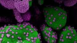 Photo courtesy of NIH Photo courtesy of NIH