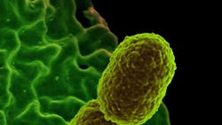 Photo courtesy of NIH Photo courtesy of NIH