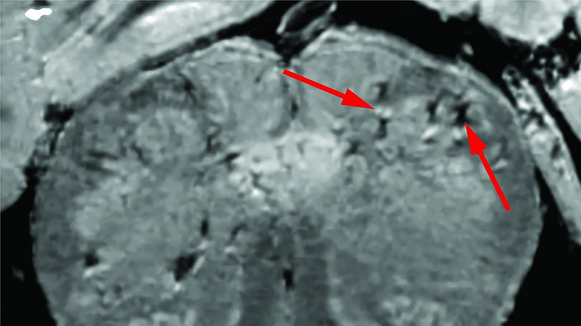 Photo courtesy of NIH