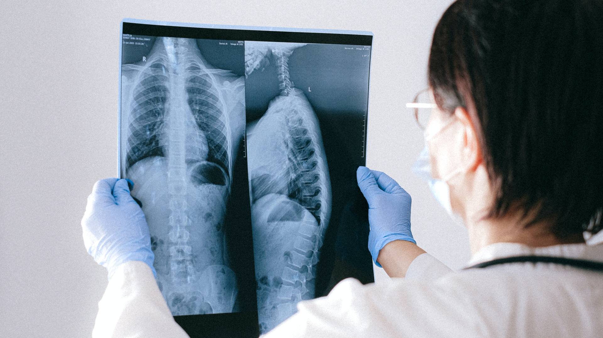 Pexels Anna Shvets 4226214 Lungs 5ff336fae8309