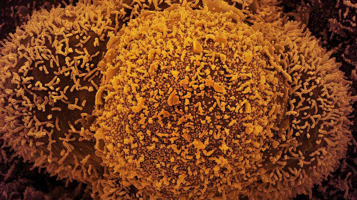 Photo courtesy of NIH and NIAID