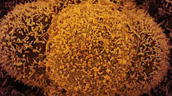 Photo courtesy of NIH and NIAID