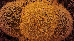 Photo courtesy of NIH and NIAID Photo courtesy of NIH and NIAID