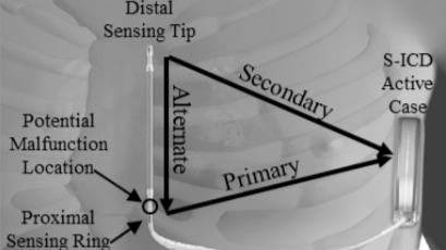 Photo courtesy of FDA