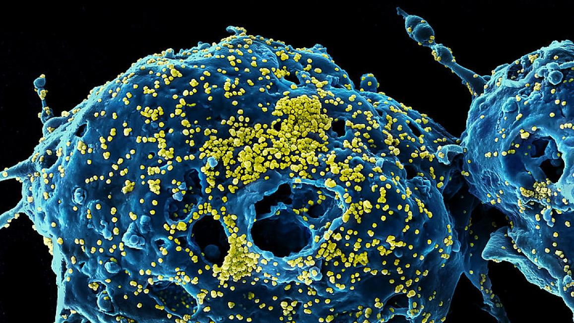 Photo courtesy of NIH and NIAID