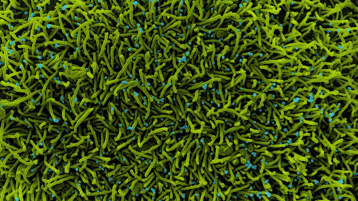 Photo courtesy of NIH and NIAID