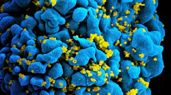Photo courtesy of NIH and NIAID