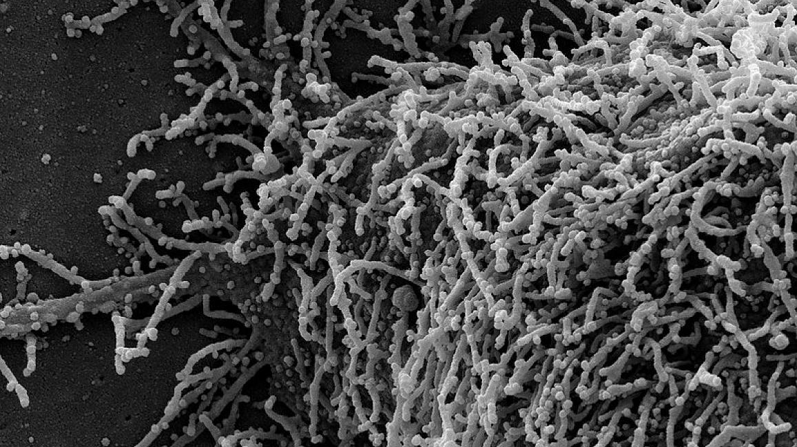 Photo courtesy of NIH and NIAID