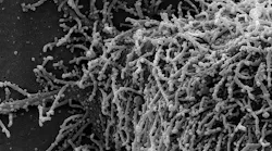 Photo courtesy of NIH and NIAID