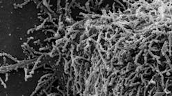 Photo courtesy of NIH and NIAID Photo courtesy of NIH and NIAID