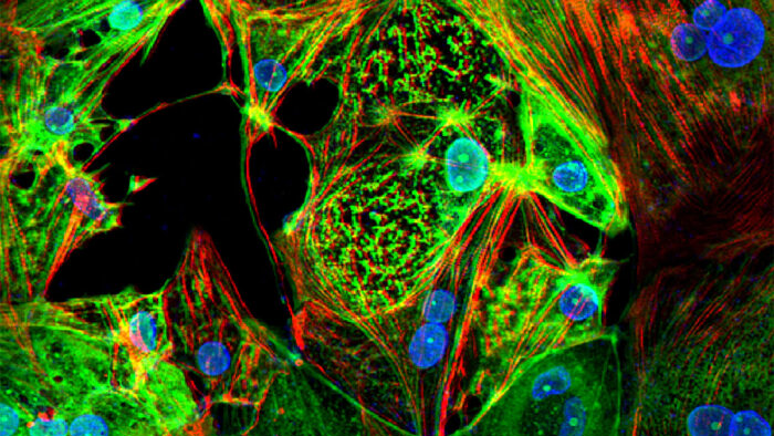 Photo courtesy of Washington University School of Medicine in St. Louis