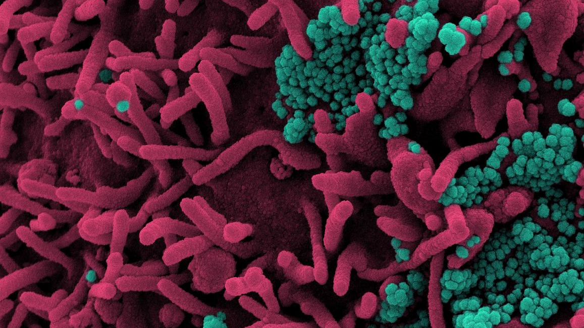 Photo courtesy of NIH and NIAID