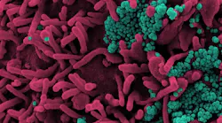 Photo courtesy of NIH and NIAID