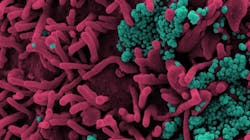 Photo courtesy of NIH and NIAID Photo courtesy of NIH and NIAID