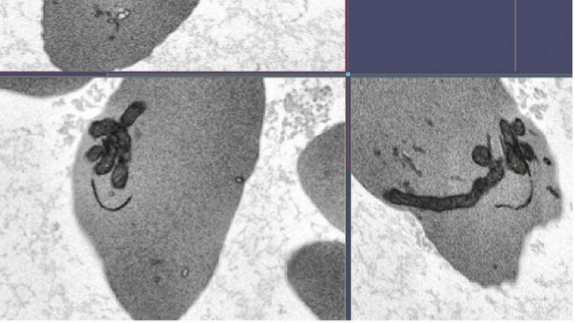 Photo courtesy of NIH and NHLBI