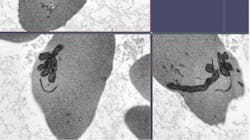 Photo courtesy of NIH and NHLBI Photo courtesy of NIH and NHLBI