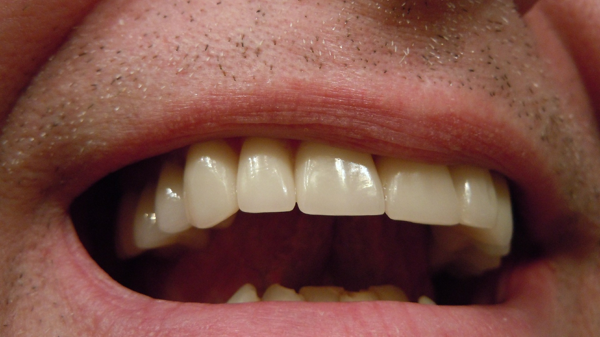 Image by John Oliver from Pixabay