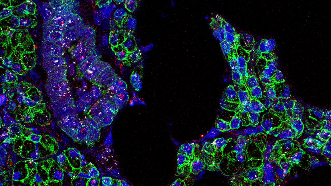 Photo courtesy of NIH and NIDCR