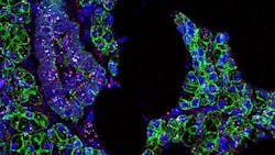 Photo courtesy of NIH and NIDCR Photo courtesy of NIH and NIDCR