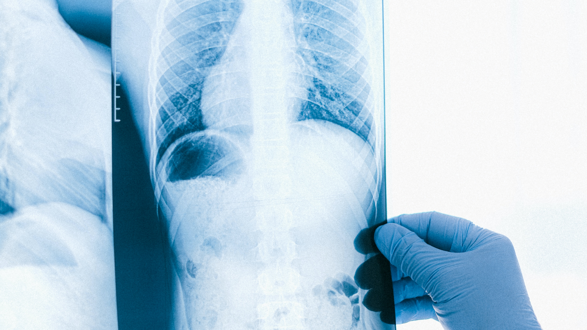 Photo by Anna Shvets from Pexels