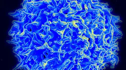 Photo courtesy of NIH and NIAID