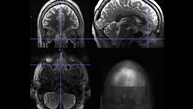 Photo Courtesy of UW School of Medicine