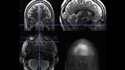 Photo Courtesy of UW School of Medicine Photo Courtesy of UW School of Medicine