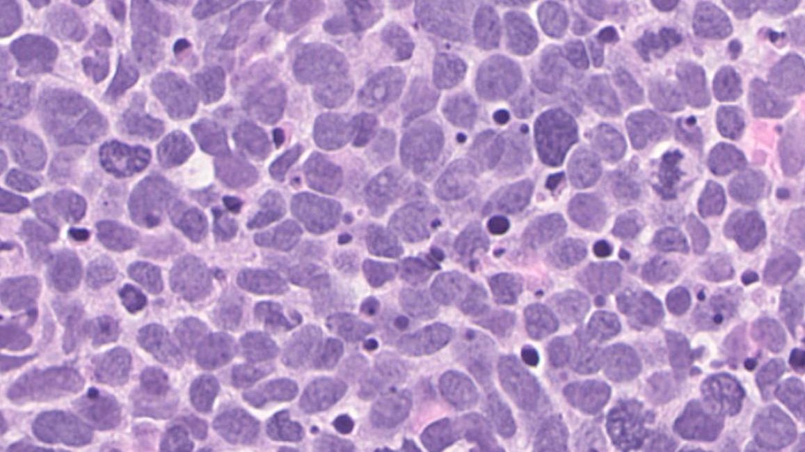 Photo courtesy of NIH and National Cancer Institute