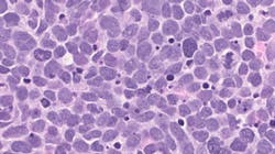 Photo courtesy of NIH and National Cancer Institute Photo courtesy of NIH and National Cancer Institute