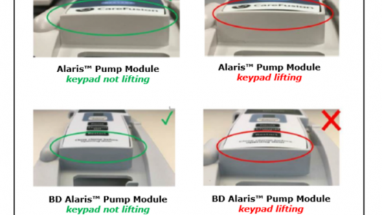 Photo courtesy of FDA