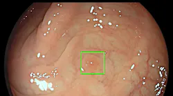 Photo courtesy of Medtronic