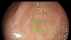 Photo courtesy of Medtronic Photo courtesy of Medtronic