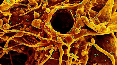 Photo courtesy of NIH and NIAID