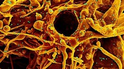 Photo courtesy of NIH and NIAID Photo courtesy of NIH and NIAID