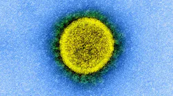Photo courtesy of NIH and NIAID
