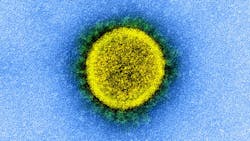 Photo courtesy of NIH and NIAID Photo courtesy of NIH and NIAID