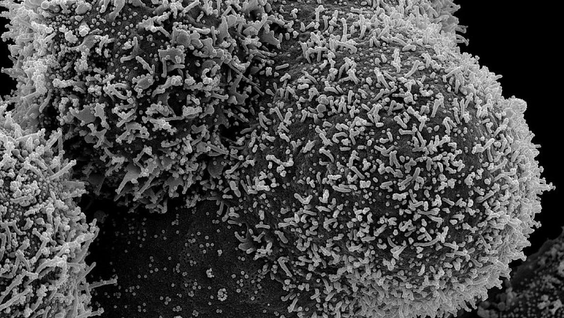 Photo courtesy of NIH and NIAID