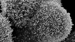 Photo courtesy of NIH and NIAID Photo courtesy of NIH and NIAID