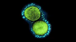 Photo courtesy of NIH and NIAID