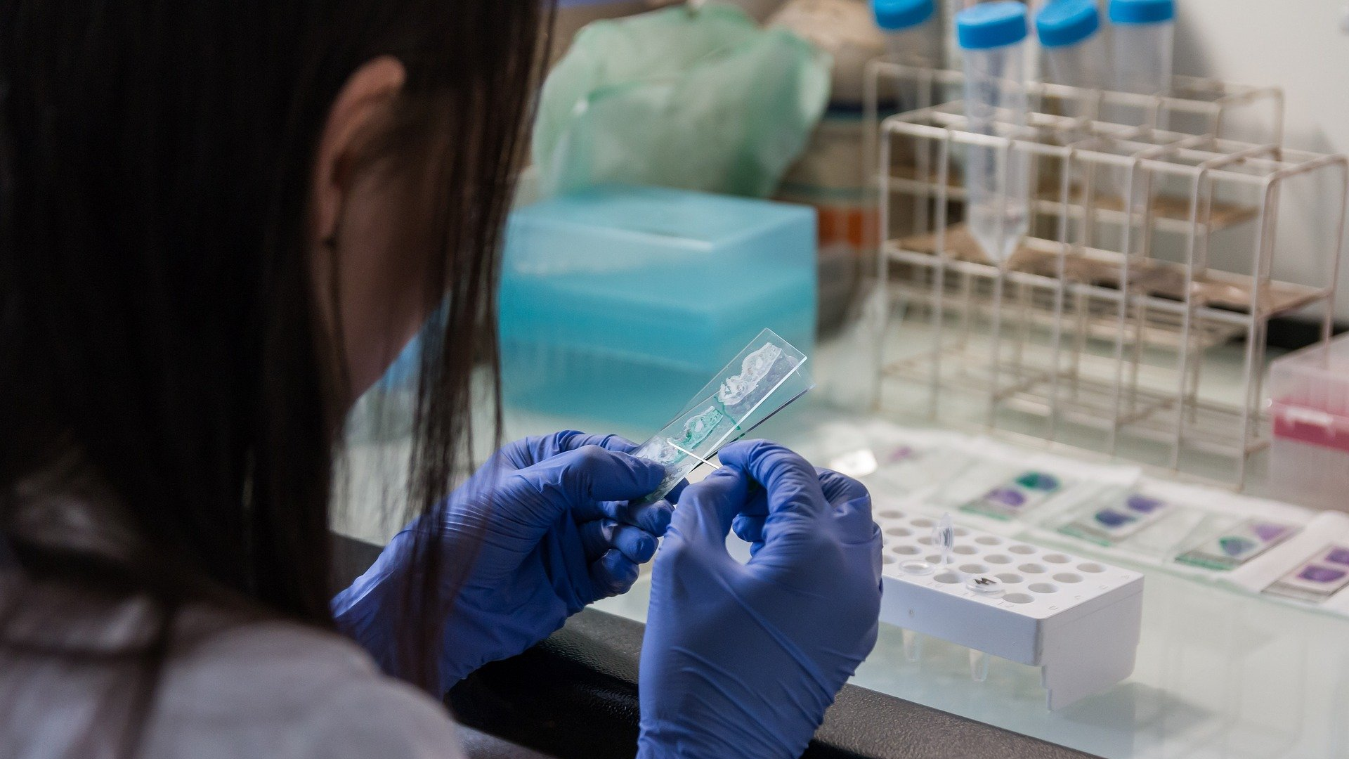 Image by Michal Jarmoluk from Pixabay