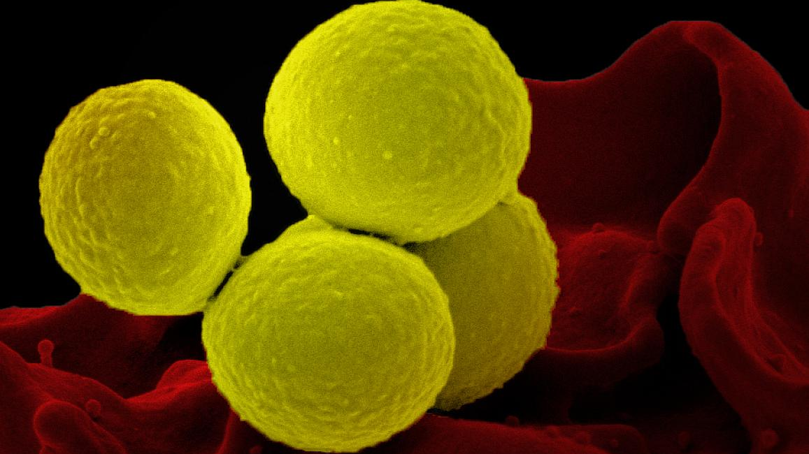 Photo courtesy of NIH and NIAID