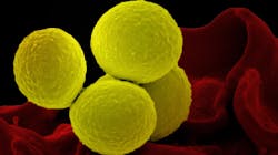 Photo courtesy of NIH and NIAID Photo courtesy of NIH and NIAID