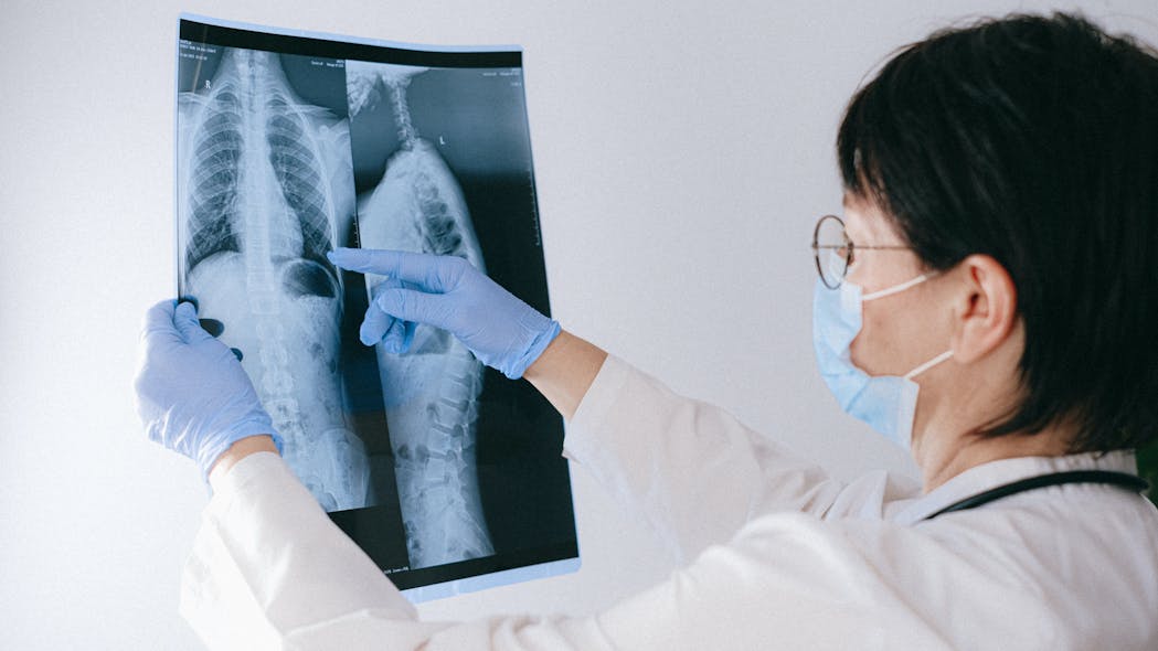 Fda Approves Targeted Therapy For Subset Of Non Small Cell Lung Cancer Pic 5 26 21du Pexels Anna Shvets 4226207 Pexels