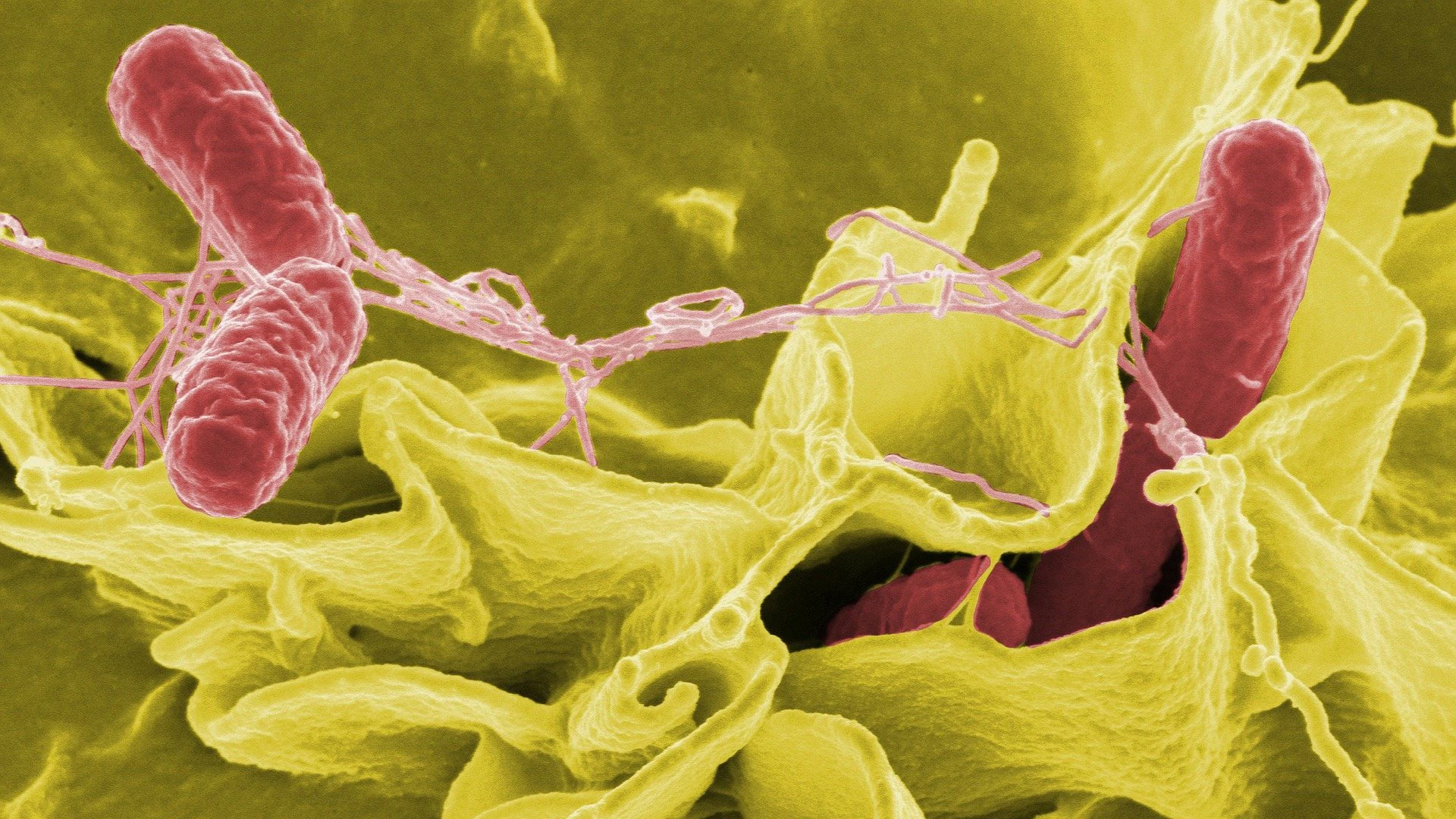 Salmonella Bacteria Under Microscope