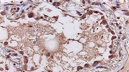 Photo courtesy of UC San Diego Health