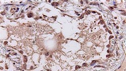 Photo courtesy of UC San Diego Health Photo courtesy of UC San Diego Health