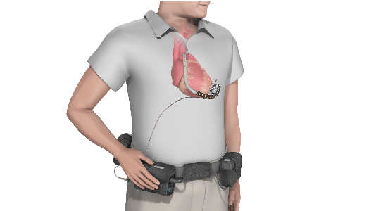 Photo courtesy of FDA