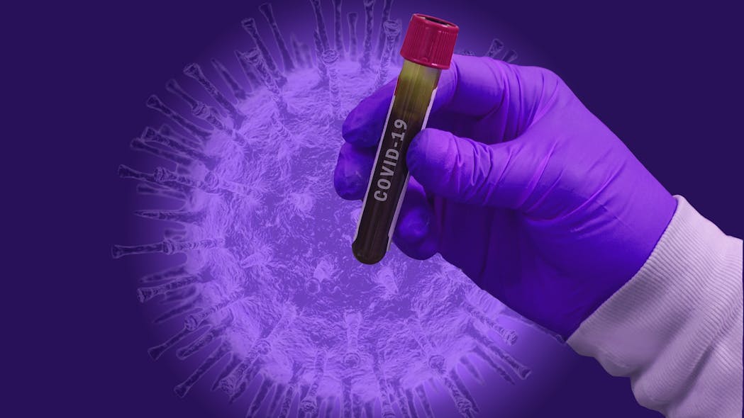 Long Covid Prevalence And Its Relationship To Epstein Barr Virus Reactivation Investigated Pic 6 24 21du Covid 19 4982912 1920 Pixabay