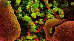 Photo courtesy of NIH and NIAID