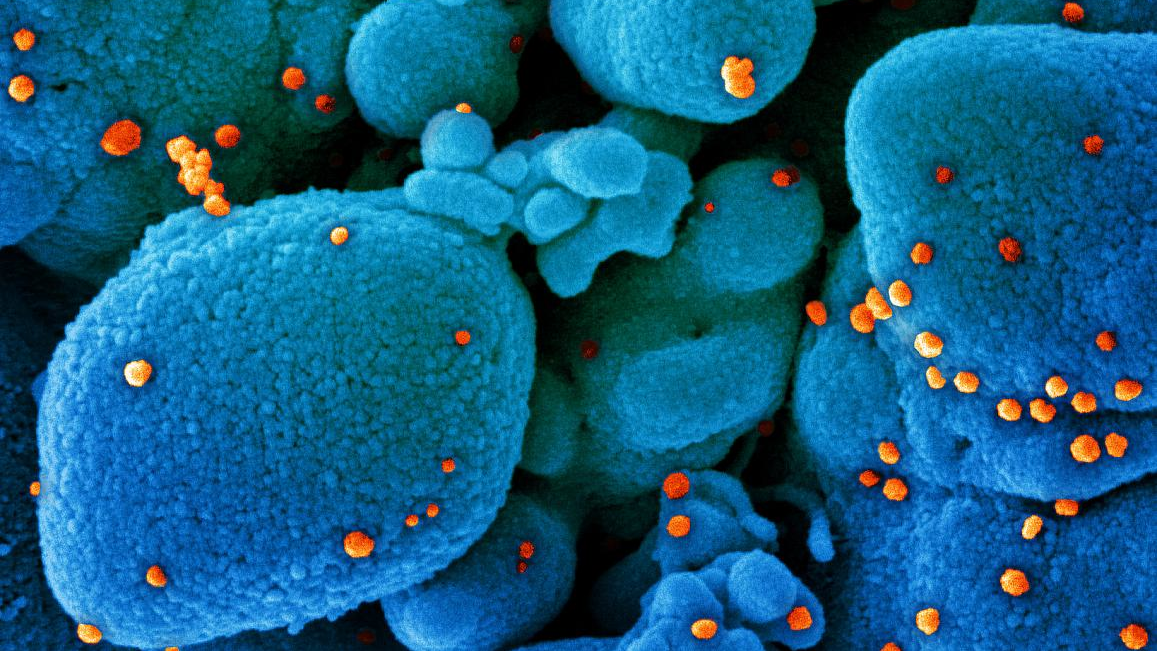 Photo courtesy of NIH and NIAID